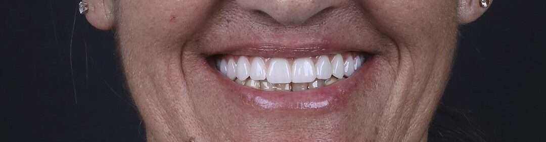 Cas Clinique 7