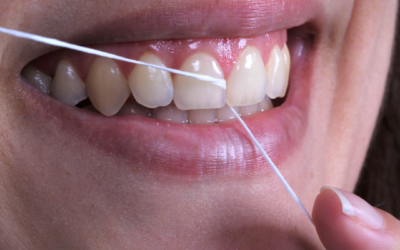 Quand doit-on passer la soie dentaire ?
