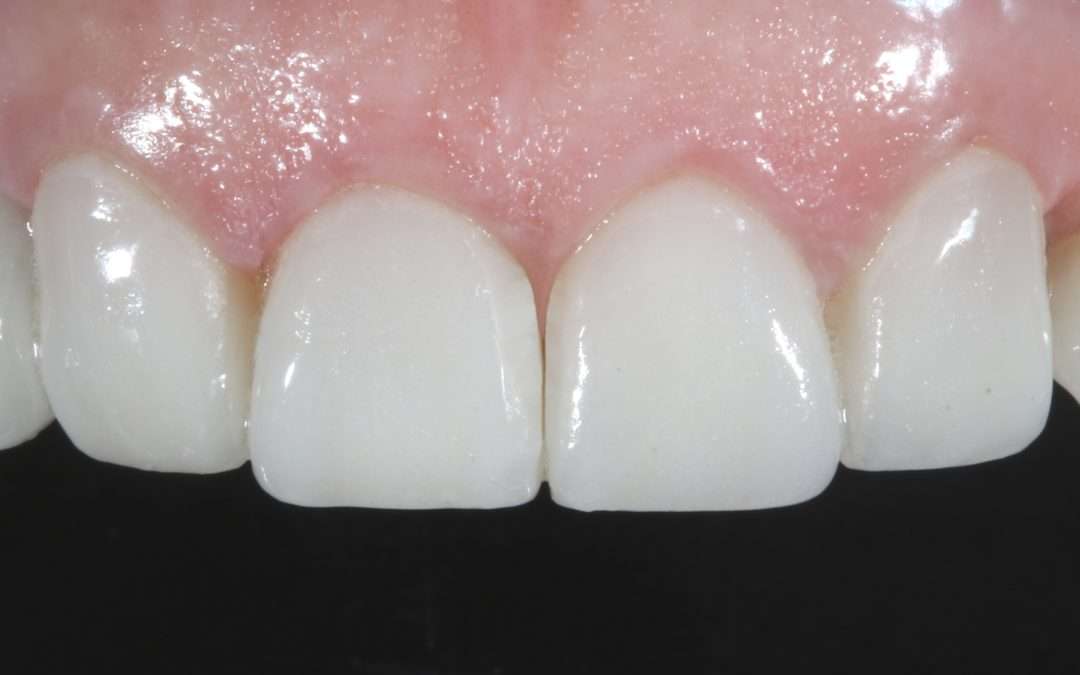 Cas Clinique 6